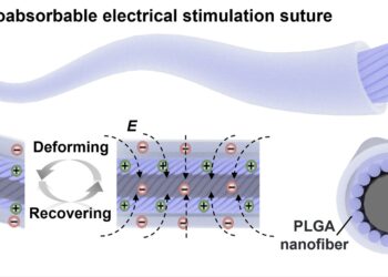 Stitches with internally produced electrical charge accelerate wound healing in rats