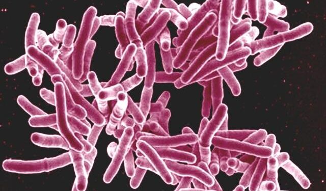 Study identifies potential new drug to treat tuberculosis