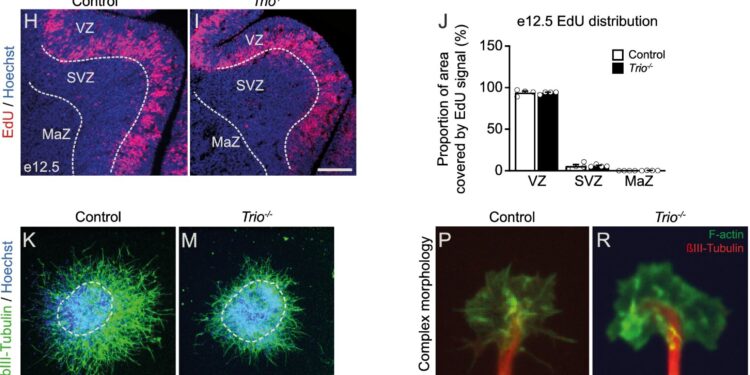 Study reveals key role of TRIO gene in epileptic encephalopathy