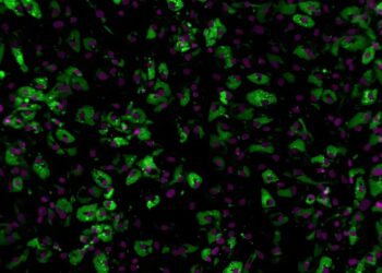 Study reveals new role for inflammatory protein in adipose tissue