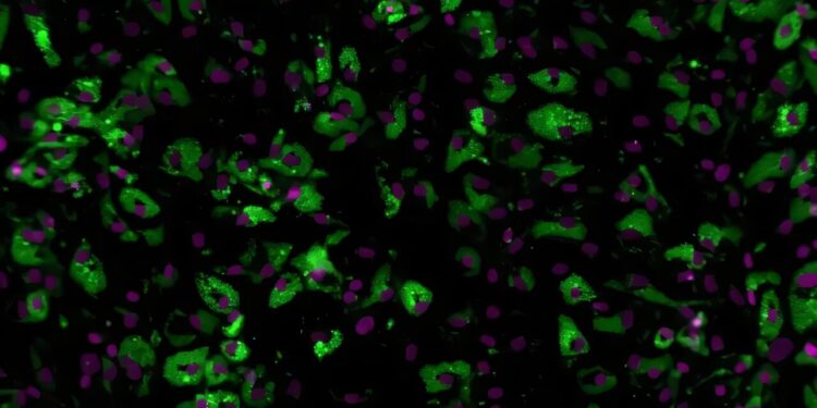 Study reveals new role for inflammatory protein in adipose tissue