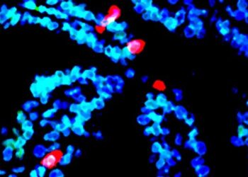 Team identifies cause of deadly ovarian cancer