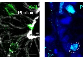 Tufted cells act as regenerative stem cells in human gut, study finds