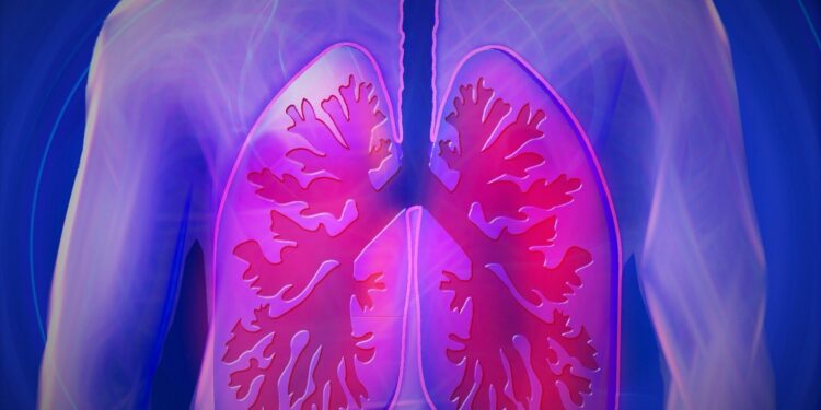 Understanding how deadly lung cancers control the local immune system