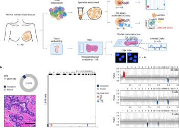 Healthy women have cells that resemble breast cancer, study finds