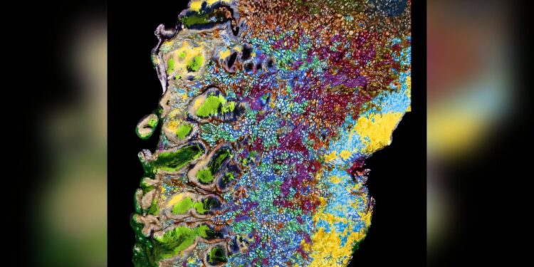 New barcode technology could help diagnose cancer more accurately
