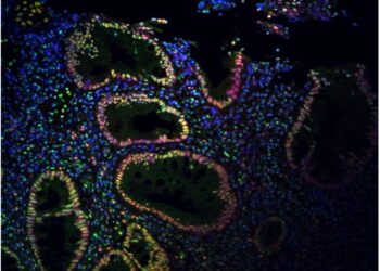 New research links vagus nerve stimulation to reduced intestinal inflammation in mice