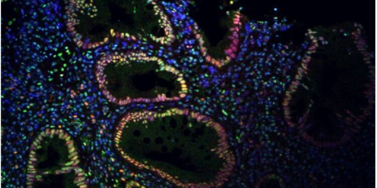 New research links vagus nerve stimulation to reduced intestinal inflammation in mice