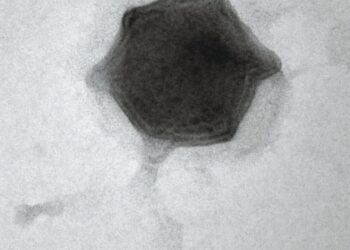 Scientists discover giant new virus that infects freshwater algae