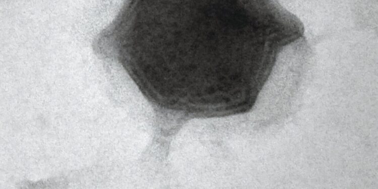 Scientists discover giant new virus that infects freshwater algae