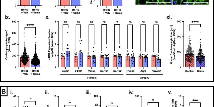 Weight-loss drug shrinks heart muscle in mice and human cells