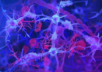 Chronic intestinal infection may play a role in the development of Alzheimer’s disease