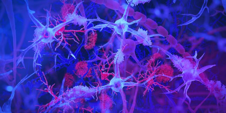 Chronic intestinal infection may play a role in the development of Alzheimer’s disease