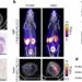 Scientists develop scanners that illuminate aggressive cancer tumors for better treatment