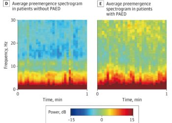 In children, EEG monitoring of consciousness can safely reduce anesthetic use