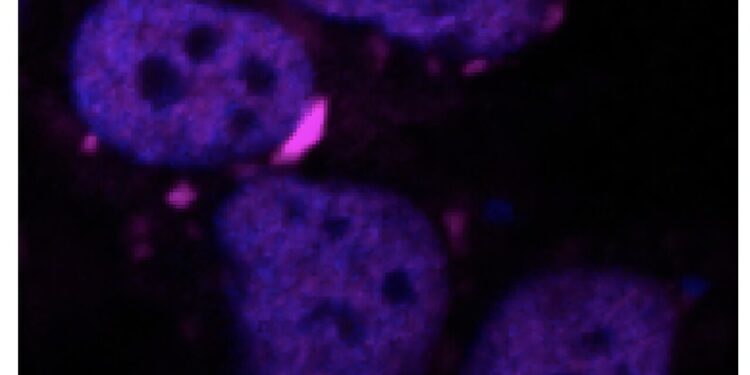 Machine learning algorithm Hunting for protein damaging the brain