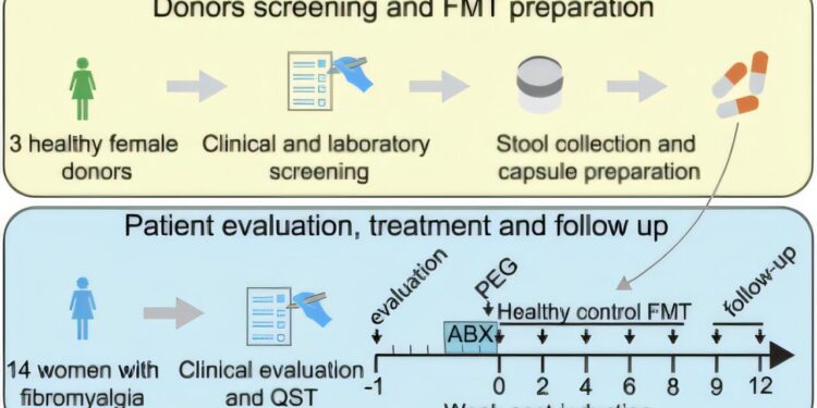 Mouses develop fibromyalgia type pain after receiving intestinal microbiota from human patients