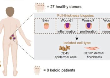 Scientists discover how circular RNA affects the healing of wounds