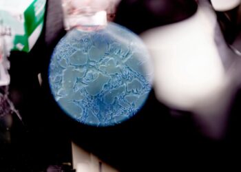 The discovery shows a potential for brain aging and therapies by the disease