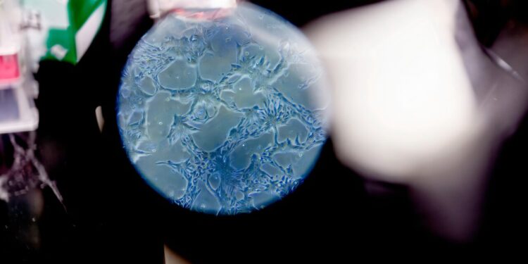 The discovery shows a potential for brain aging and therapies by the disease
