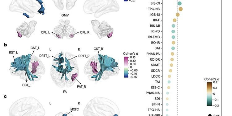 The study explores the impact of growth without brothers and sisters on the brain and the behavior of adults