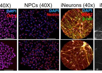 A protein attenuates Huntington’s disease, and it is exacerbated