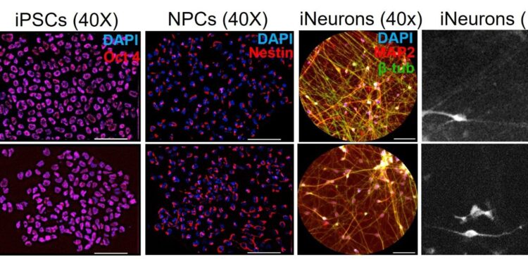 A protein attenuates Huntington’s disease, and it is exacerbated
