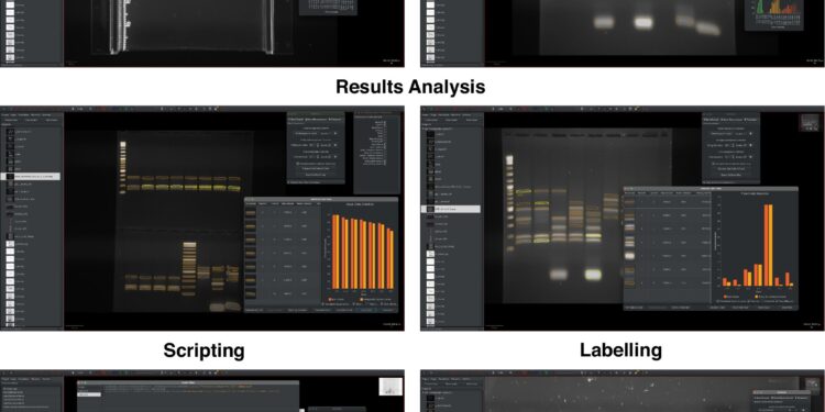 AI eliminates the boredom of electrophoresis on frost with a quick and precise analysis