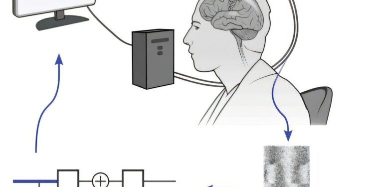 The brain interface allows speech decoding and computer control in the patient ALS
