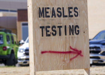 The United States is experiencing its worst measles epidemic in more than 30 years