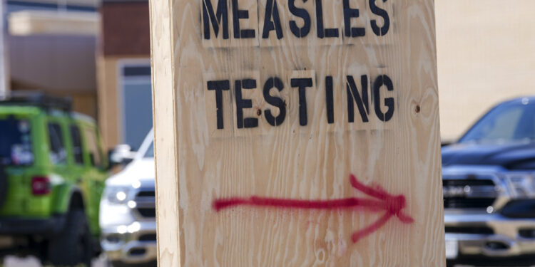 The United States is experiencing its worst measles epidemic in more than 30 years