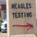 The United States is experiencing its worst measles epidemic in more than 30 years