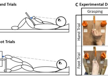 Brain analyzes reveal an organization based on action in people born without hands
