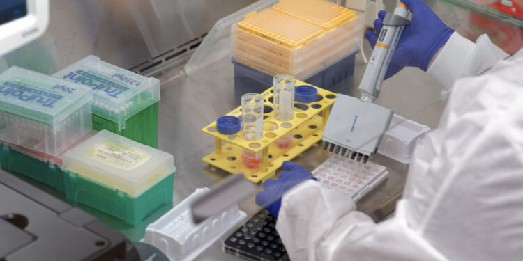 Stem cells created from SLA patients point to a new potential target for treatment