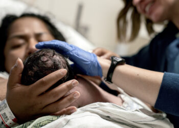 “We lose money” | The press