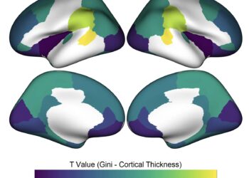 Living in an unequal society impacts children’s brain structure, study finds