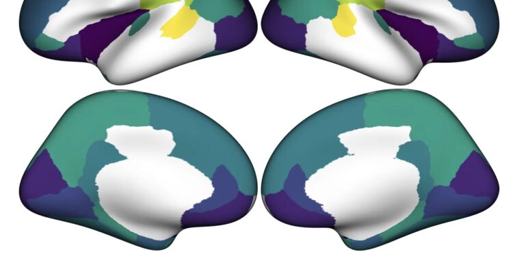 Living in an unequal society impacts children’s brain structure, study finds