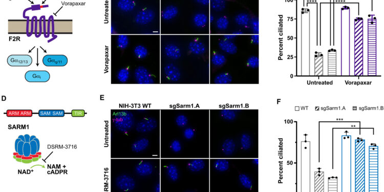 Pathway provides new insights into how cilia on cell surfaces break down before division