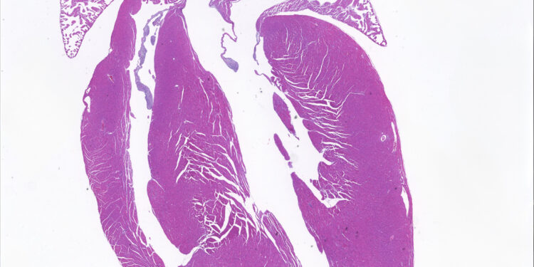 Precise gene editing technique modifies a DNA base to correct heart disease