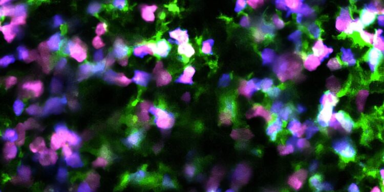 Scientists reprogram cancer cell death to trigger immune system