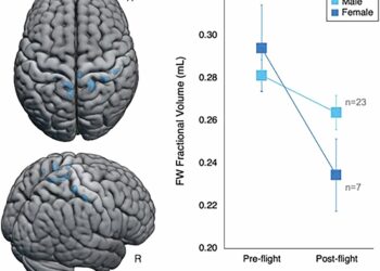 Spaceflight study finds men experience greater eye changes, while brain differences between sexes are subtle