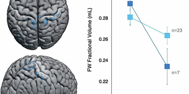 Spaceflight study finds men experience greater eye changes, while brain differences between sexes are subtle