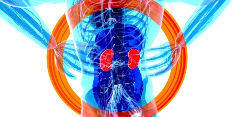 Chronic kidney failure now ninth leading cause of death, global analysis finds
