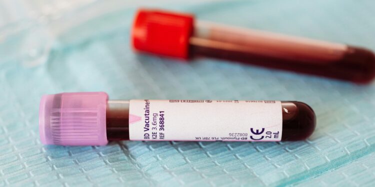 Disagreement between two kidney function tests predicts serious health problems