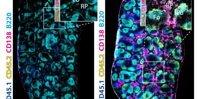 Downregulation of CD21 triggers harmful B cells in lupus