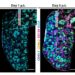 Downregulation of CD21 triggers harmful B cells in lupus