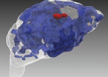 Heavy cannabis use during pregnancy linked to disrupted brain growth