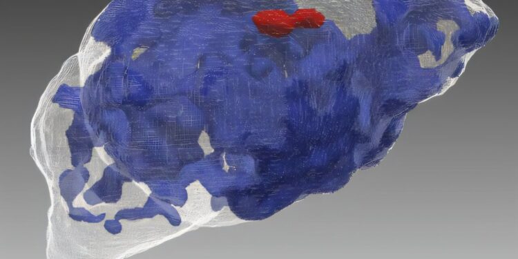 Heavy cannabis use during pregnancy linked to disrupted brain growth