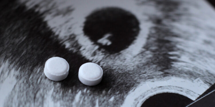 Supreme Court invalidates laws | Abortion remains legal in Wyoming